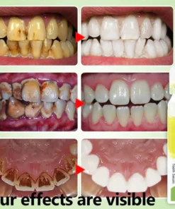 Oveallgo™ PRO Ampoule Tooth Serum