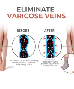 Oveallgo™ Self-Heating Tech Anti Edema Compression Socks