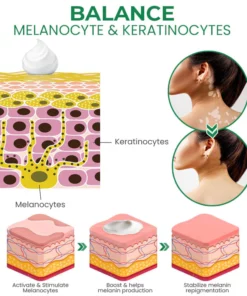 Oveallgo™ VitiligoFix Revitalize Elixir