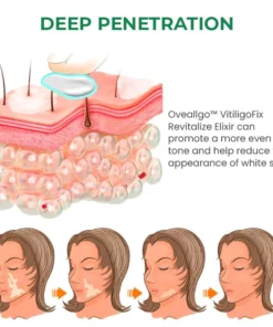 Oveallgo™ VitiligoFix Revitalize Elixir