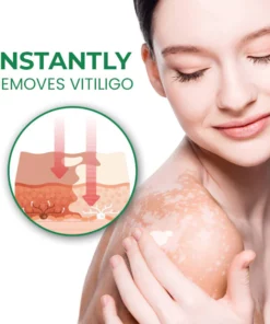 Oveallgo™ VitiligoFix Revitalize Elixir