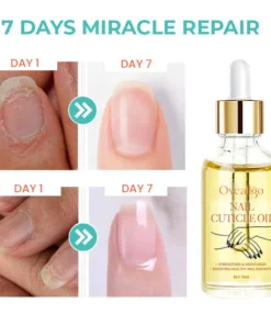Oveallgo™ XtraRich Vitamin Nail Strengthening Cuticle Oil