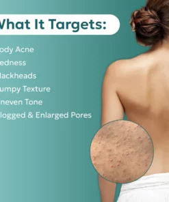 PureBAC™ Back Acne Herbal Spray