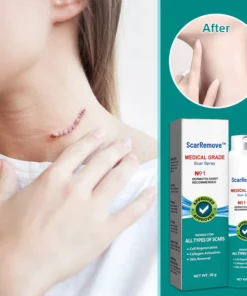 Alternative view of ScarRemove™ Scar and Stretch Mark Refining Spray