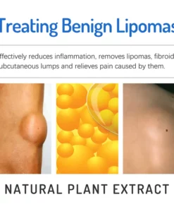 Alternative view of South Moon LumpFree Lipoma Removal Cream