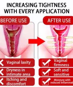 Alternative view of VitiFex™ Postpartum Pelvic Bone Closure Capsule