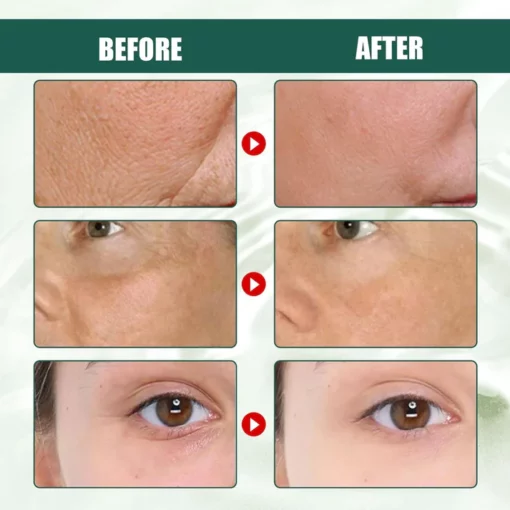 30 Day Anti-Aging Treatment Essence - Image 6