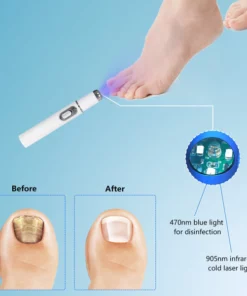 ARRIVALS Antifungal Laser Device Without Any Side Effects