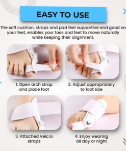 Alayna™ 3D Bunion Splint Corrector