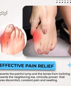 Alayna™ 3D Bunion Splint Corrector