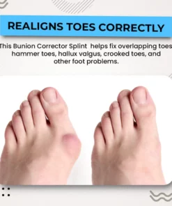Alayna™ 3D Bunion Splint Corrector