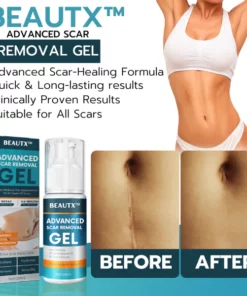 Alternative view of BEAUTX™ Advanced Scar Removal Gel