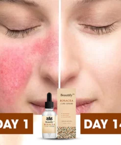 Beautify™ Rosacea Cure Serum