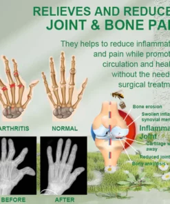 Beevana™ Bee Venom Professional Care Gel