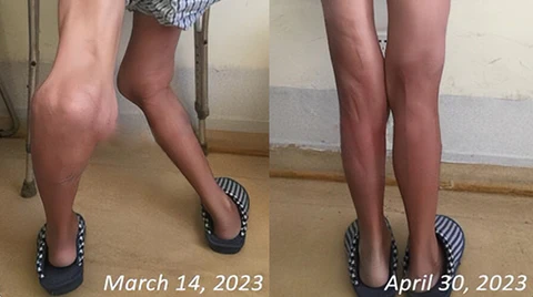 Beevana™ Bee Venom Professional Care Gel