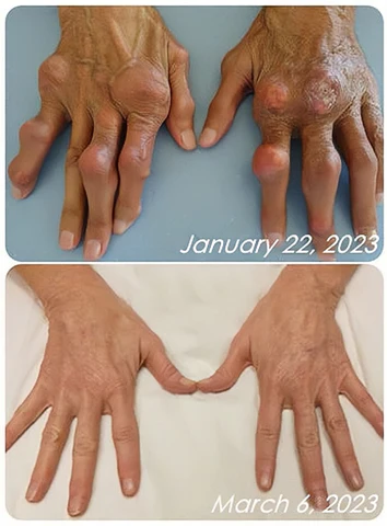 Beevana™ Bee Venom Professional Care Gel