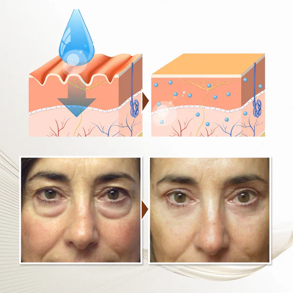 Peptidový liftingový oční gel Biancat™ RevAge