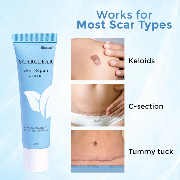 Biancat™ ScarClear krema za obnavljanje kože