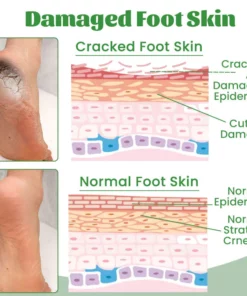 Biancat™ Heel Repair & Hydration Cream