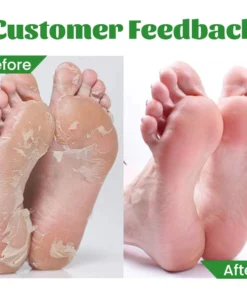 Biancat™ Heel Repair & Hydration Cream