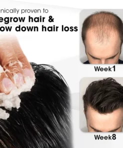 Biancat™ PrestigeStrand Hair Regrowth Scrub