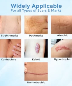 Biancat™ ScarClear Skin Repair Cream