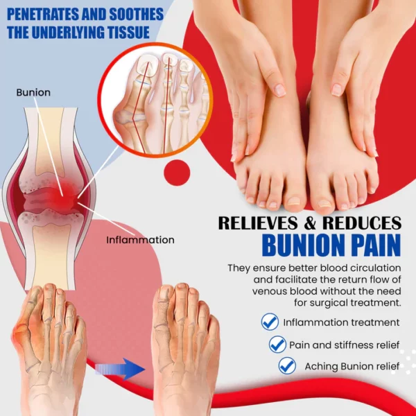 CC™ Bunion Pain Relief Cream