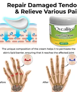 CNDB Oveallgo™ Bee Sting Joint and Bone Therapy Cream