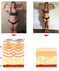 CNDB TENS Hypertension Therapy Massager Sticker