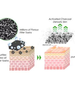 CNDB flysmus™ Acanthosis Nigricans Treatment Bamboo Charcoal Soap