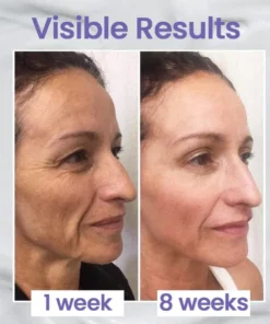 Ceoerty™ Brightening Anti-Wrinkle Cream