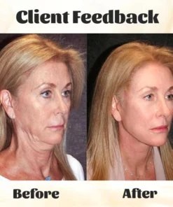 Ceoerty™ RevTime NMN Age-Defying Essence