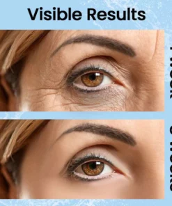 Ceoerty™ Youth Magic Electric Massage Eye Cream