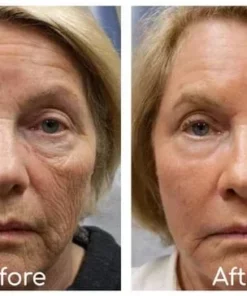 Collagen Boost Permanent Anti-Aging Serum