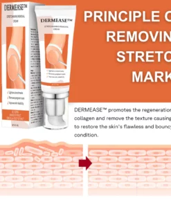 DERMEASE™ Stretchmarks Removal Cream