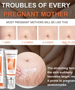 DERMEASE™ Stretchmarks Removal Cream