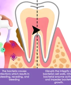 DentiCare™ Gum Treatment Foam
