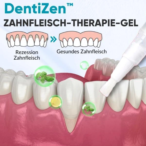 DentiZen™ Zahnfleisch 治療凝膠