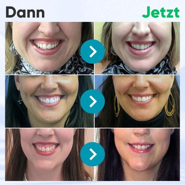DentiZen™ Zahnfleisch-Therapie-Jel