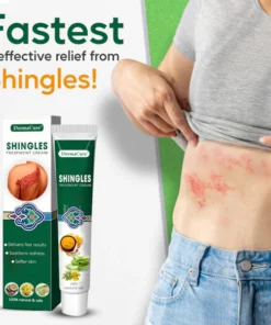 DermaCure™ Shingles Treatment Cream