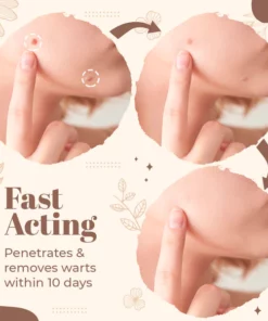 Derma'Pro Mole & Wart Removal Treatment Set