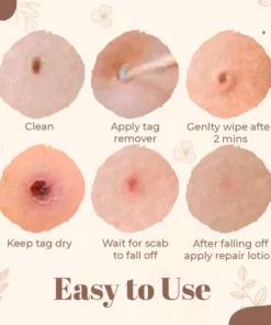 Derma'Pro Mole & Wart Removal Treatment Set