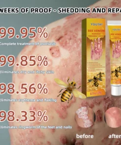 EdiJonah® Bee Venom Psoriasis Treatment Cream