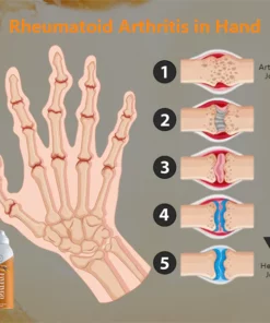 Fivfivgo™ Bee Venom Joint & Bone Therapy Spray