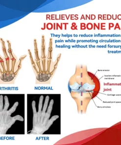 Fivfivgo™ Gelenk- und Knochentherapie-Gel - Ganzkörper-Wiederherstellung