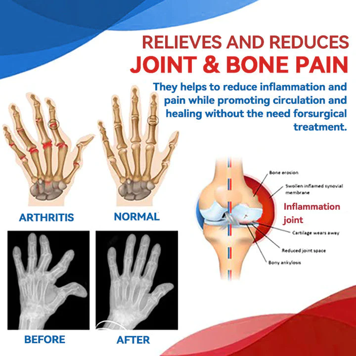 Fivfivgo™ Gelenk- und Knochentherapie-Gel - Ganzkörper-Wiederherstellung