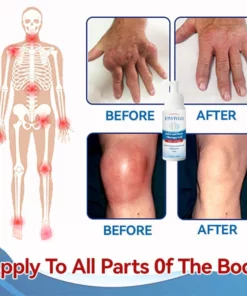 Fivfivgo™ Gelenk- und Knochentherapie-Gel - Ganzkörper-Wiederherstellung