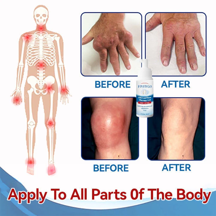 Fivfivgo™ Gelenk- und Knochentherapie-Gel - Ganzkörper-Wiederherstellung