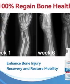 Fivfivgo™ Gelenk- und Knochentherapie-Gel - Ganzkörper-Wiederherstellung