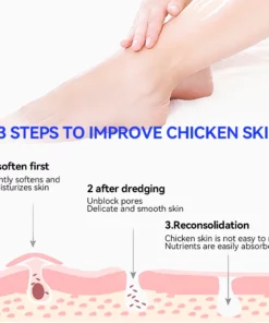 Fivfivgo™ Keratosis Pilaris & Akne Behandlung Körper Erfrischende Creme